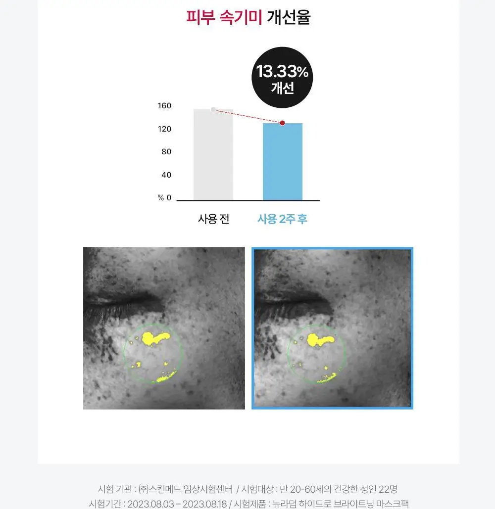 [2주 기미/잡티 삭제] 메디톡스 뉴라덤 하이드로 브라이트닝 마스크팩 1매/5매 (하이드로겔) 상세페이지 21